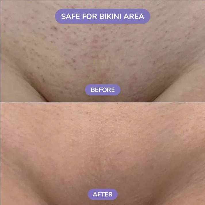 Magic Crystal Hair Remover Painless Exfoliation Hair Removal Tool for Women and Men